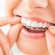 Invisalign in Langford BC
